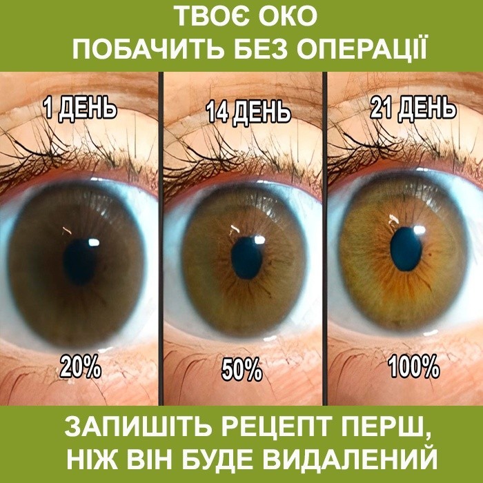 кейс зрение