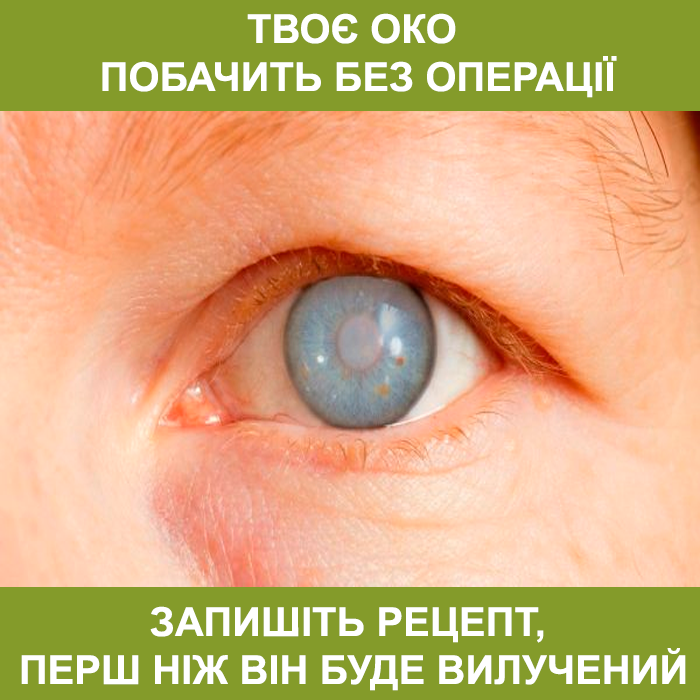 кейс зрение