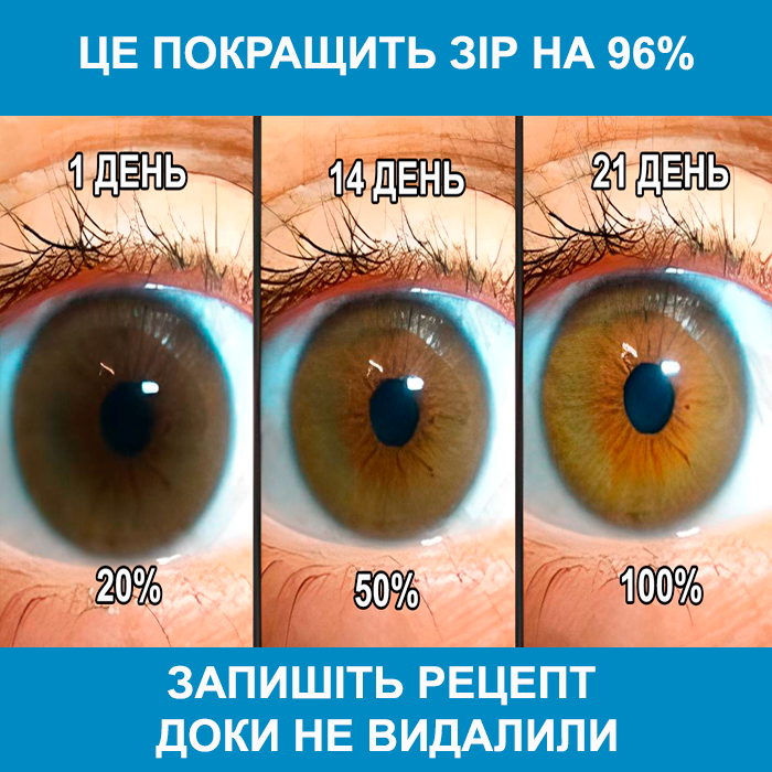 кейс зрение