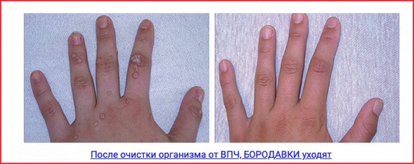 текст для прелендинга
