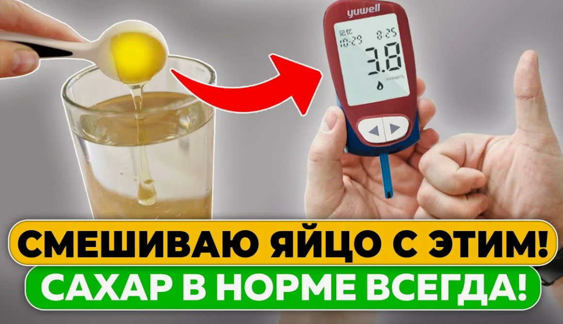 Креативы для тизерных сетей | Изображение 9